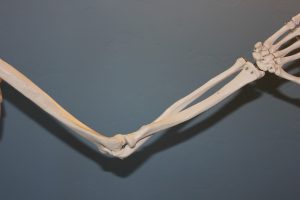 Arthritis Pain Management Tips