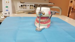 Dentures: History and Types