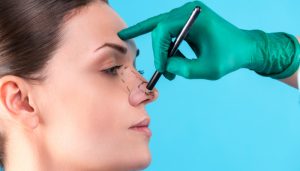 What you Should Know About Rhinoplasty