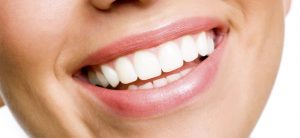 What is Teeth Whitening and How is it Achieved?